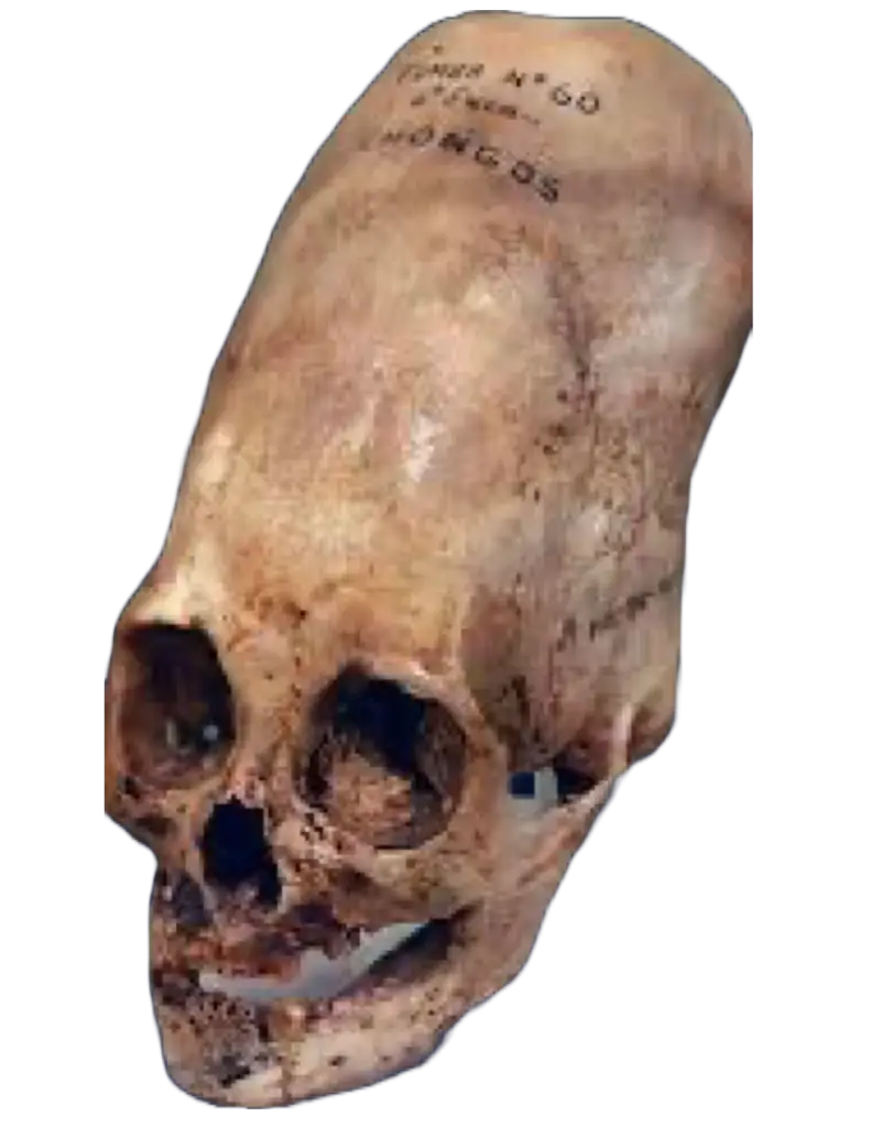 paracas elonaged skull